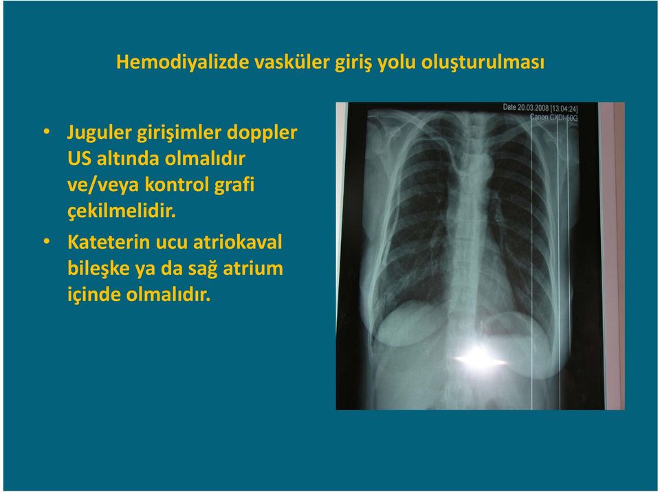 ve/veya kontrol grafi çekilmelidir.