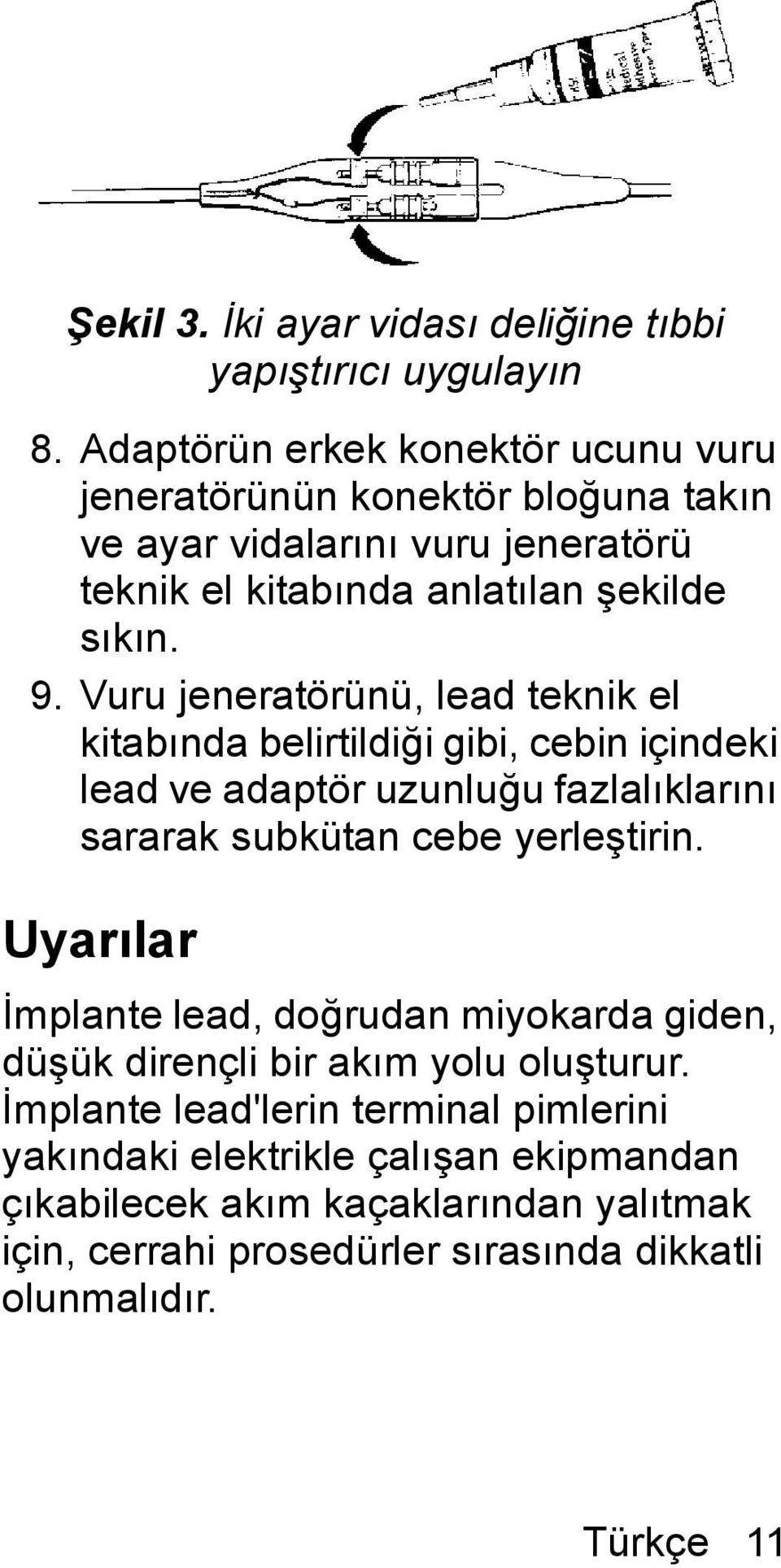 Vuru jeneratörünü, lead teknik el kitabında belirtildiği gibi, cebin içindeki lead ve adaptör uzunluğu fazlalıklarını sararak subkütan cebe yerleştirin.