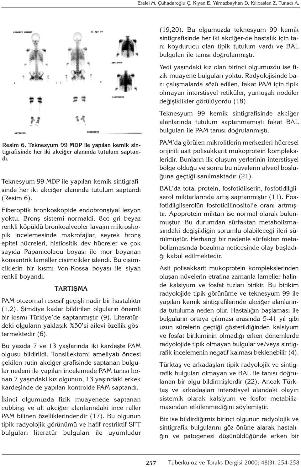 Yedi yaşındaki kız olan birinci olgumuzdu ise fizik muayene bulguları yoktu.