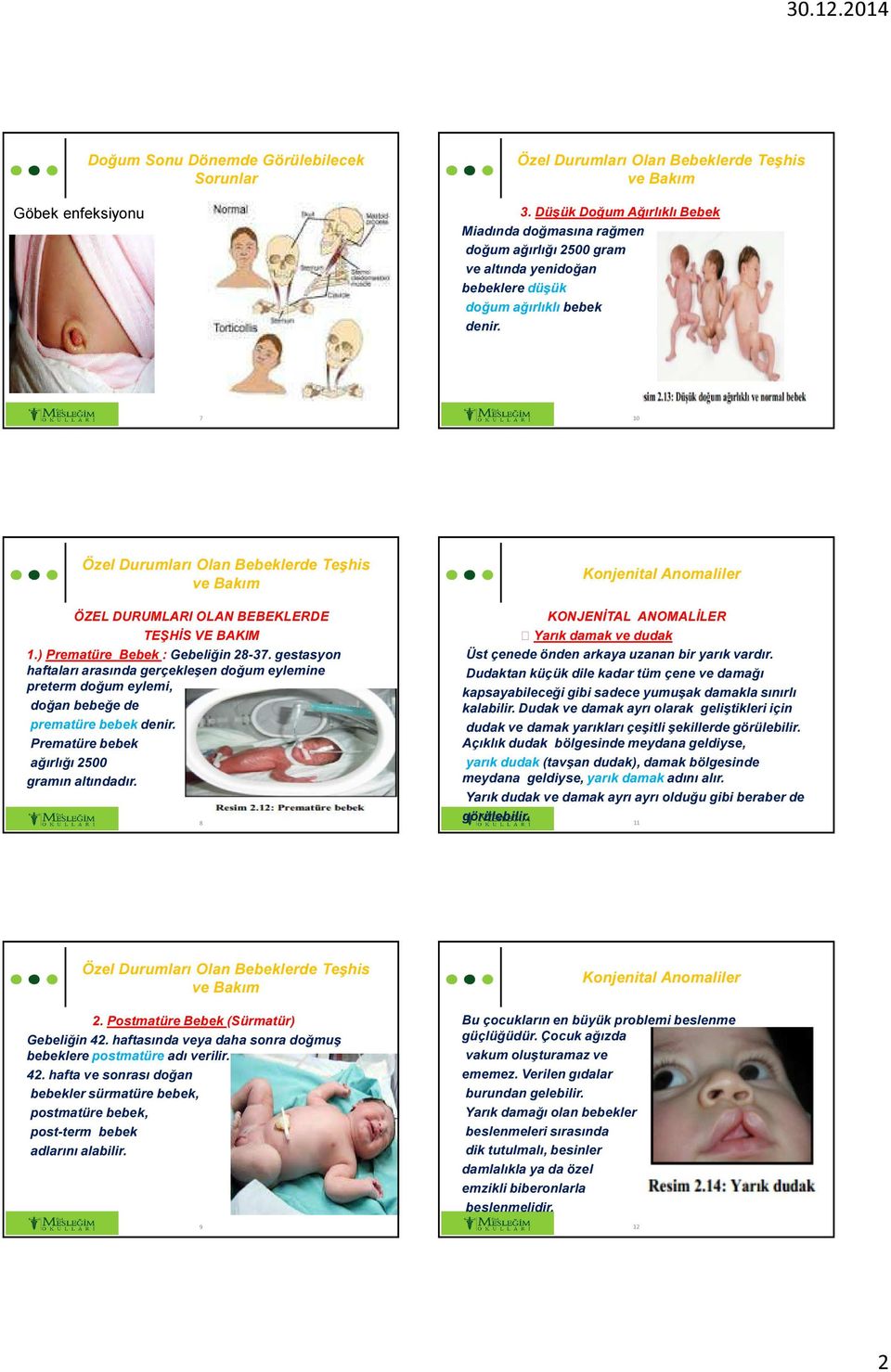 ) Prematüre Bebek : Gebeliğin 28-37. gestasyon haftaları arasında gerçekleşen doğum eylemine preterm doğum eylemi, doğan bebeğe de prematüre bebek denir.