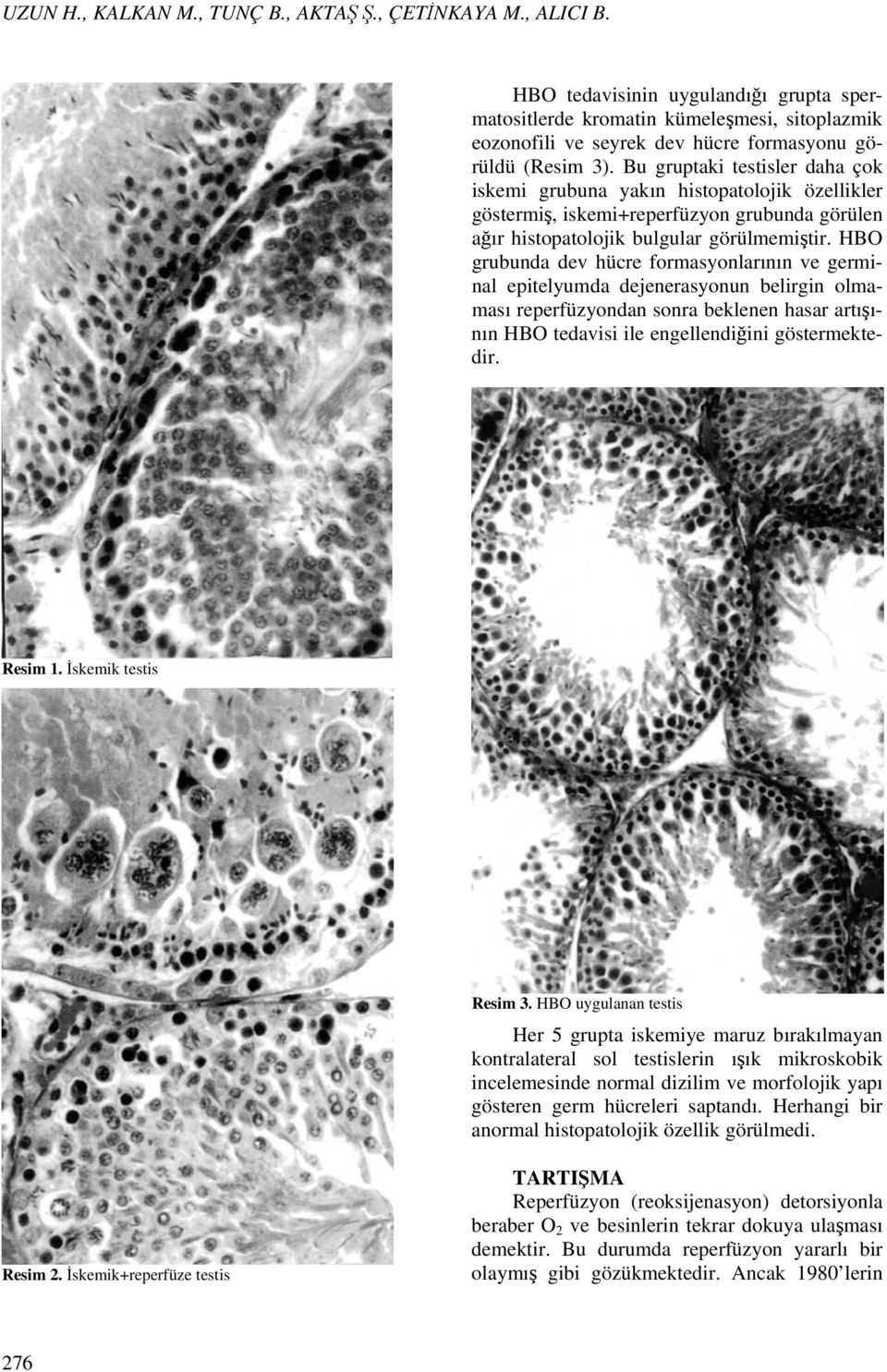 Bu gruptaki testisler daha çok iskemi grubuna yakın histopatolojik özellikler göstermiş, iskemi+reperfüzyon grubunda görülen ağır histopatolojik bulgular görülmemiştir.