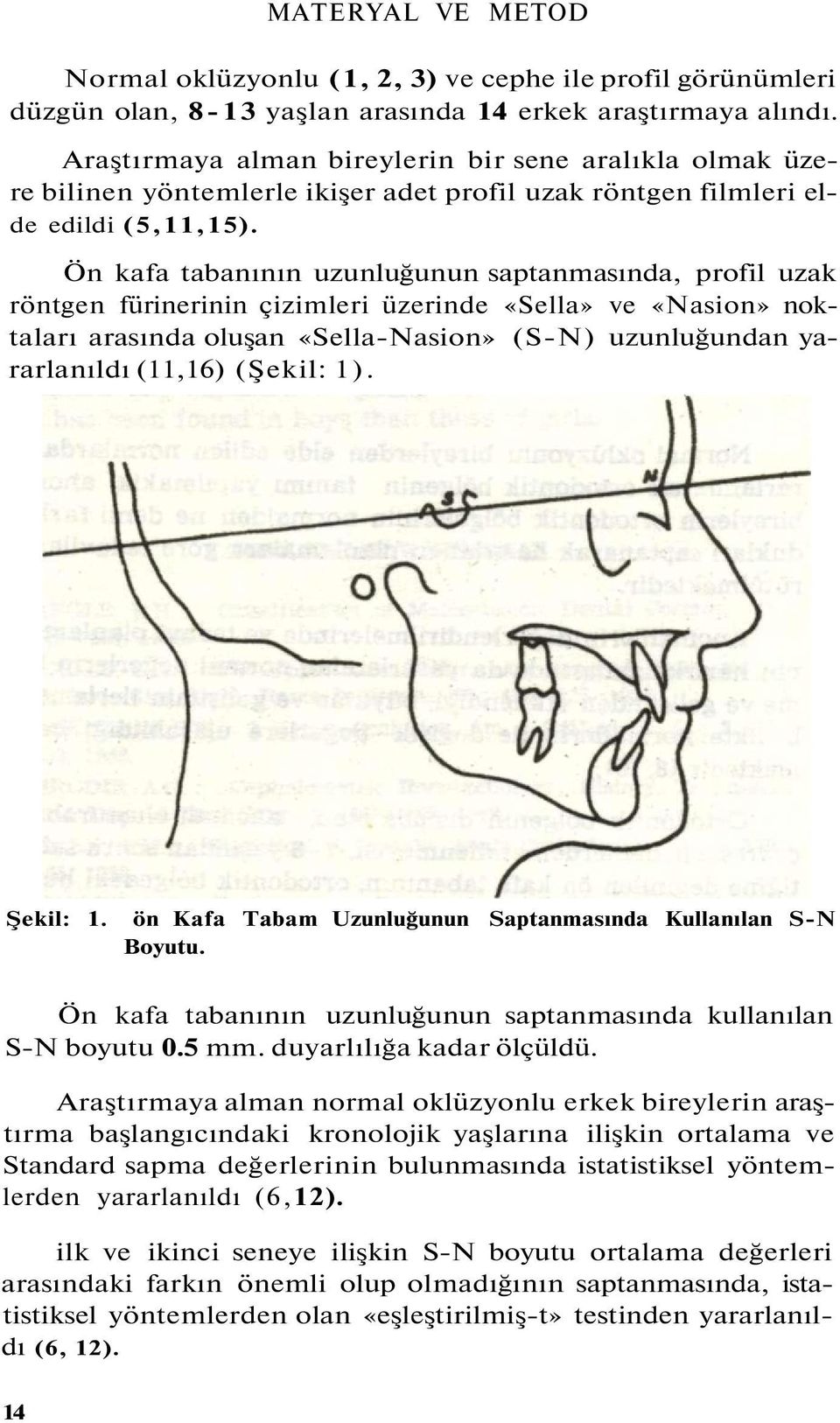 Ön kafa tabanının uzunluğunun saptanmasında, profil uzak röntgen fürinerinin çizimleri üzerinde «Sella» ve «Nasion» noktaları arasında oluşan «Sella-Nasion» (S-N) uzunluğundan yararlanıldı (11,16)