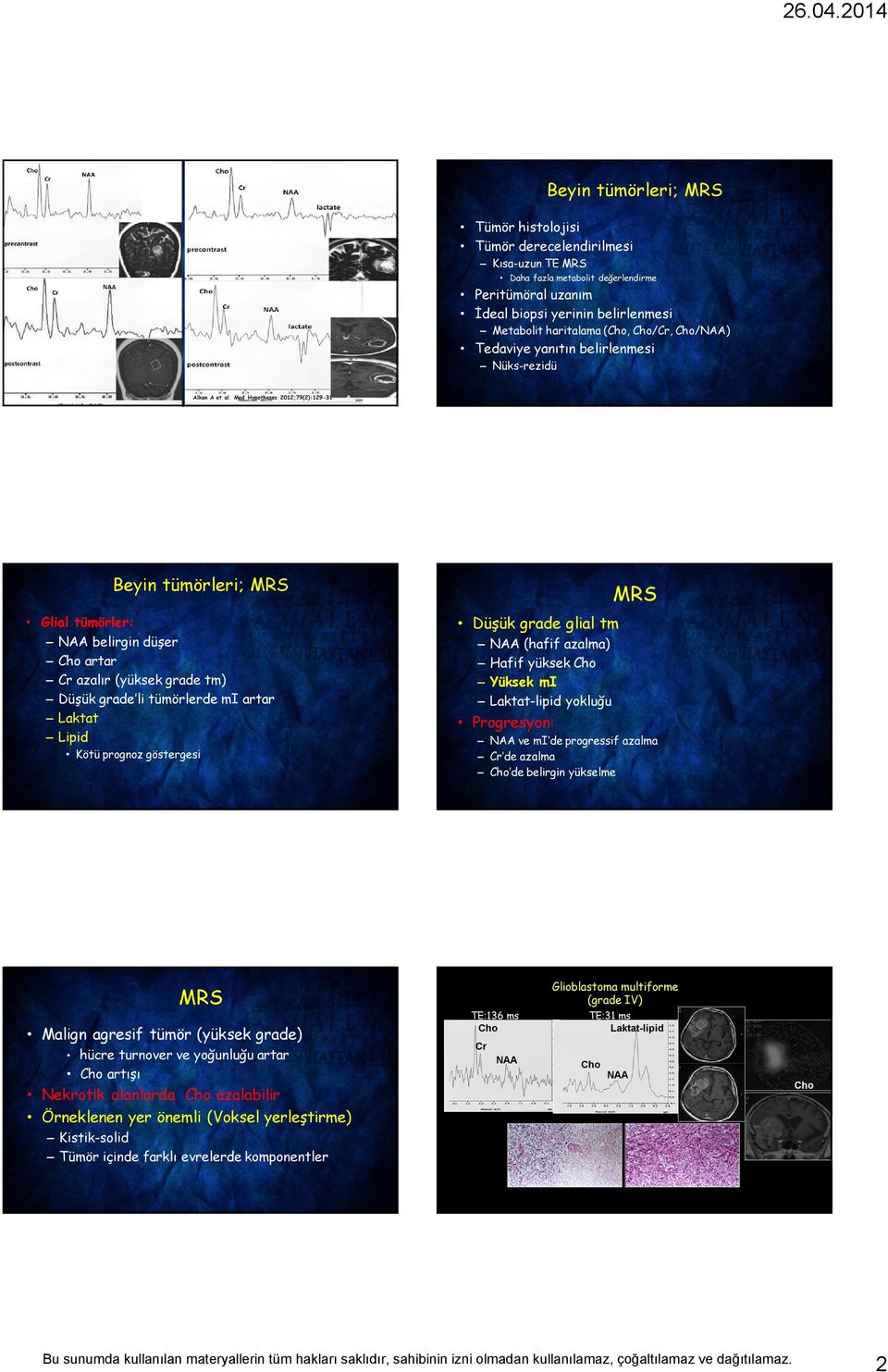 Med Hypotheses 2012;79(2):129-31 Glial tümörler: Beyin tümörleri; MRS NAA belirgin düşer Cho artar Cr azalır (yüksek grade tm) Düşük grade li tümörlerde mi artar Laktat Lipid Kötü prognoz göstergesi