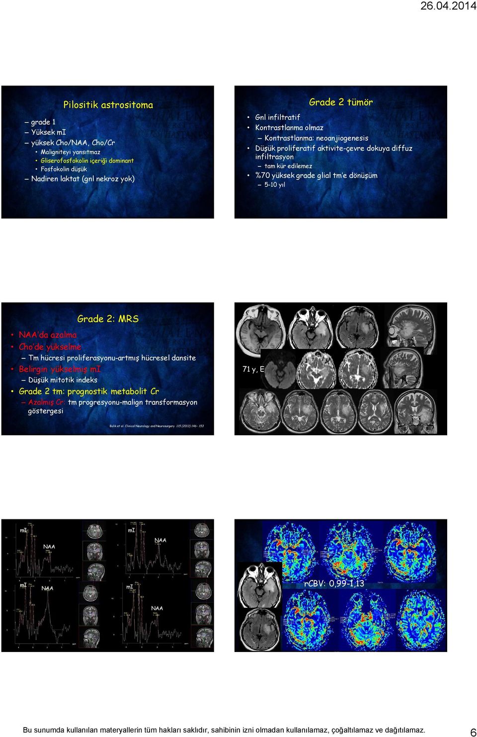 e dönüşüm 5-10 yıl Grade 2: MRS NAA da azalma Cho de yükselme Tm hücresi proliferasyonu-artmış hücresel dansite Belirgin yükselmiş mi Düşük mitotik indeks Grade 2 tm: prognostik