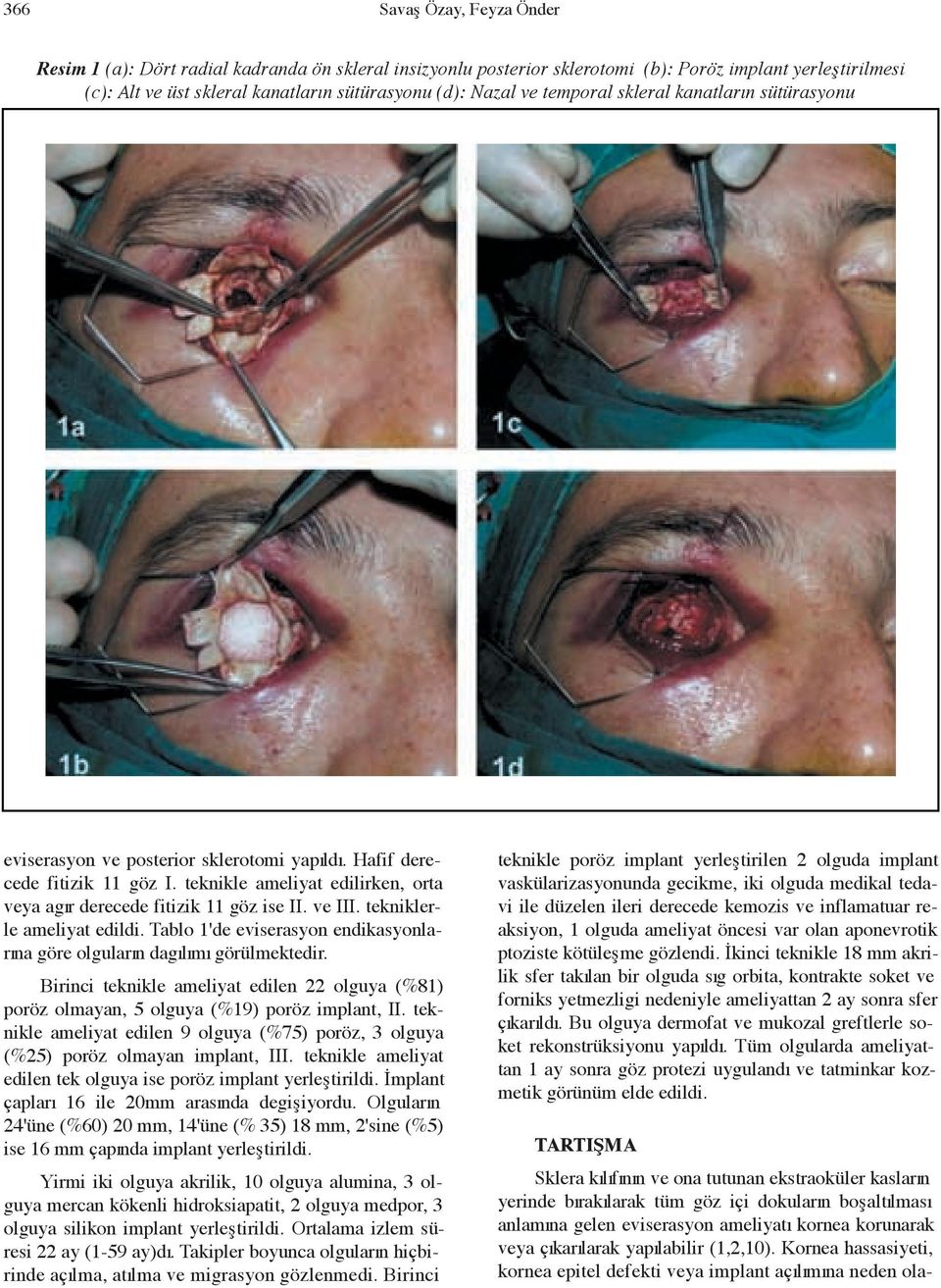 ve III. tekniklerle ameliyat edildi. Tablo 1'de eviserasyon endikasyonlar na göre olgular n dag l m görülmektedir.