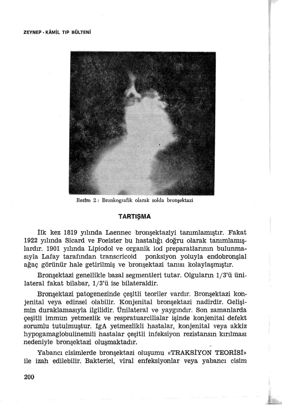 90 yılında Lipiodol ve organik iod preparatlarının bulunmasıyla Lafay tarafından transcricoid ponksiyon yoluyla endobronşial ağaç görünür hale getirilmiş ve bronşektazi tanısı kolaylaşmıştır.