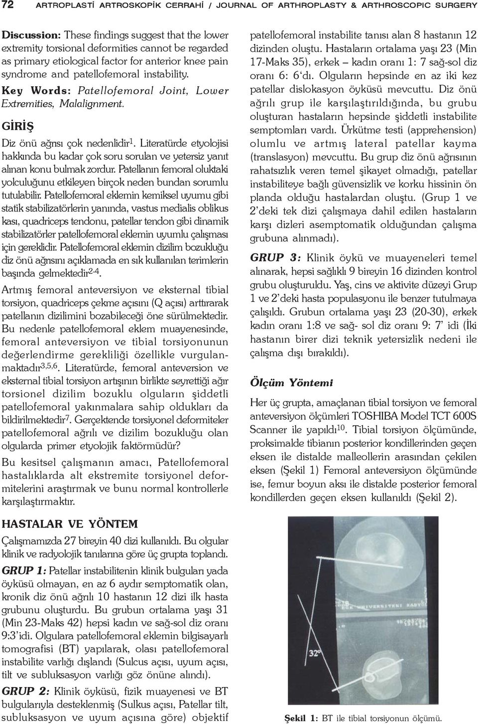 Literatürde etyolojisi hakkýnda bu kadar çok soru sorulan ve yetersiz yanýt alýnan konu bulmak zordur. Patellanýn femoral oluktaki yolculuðunu etkileyen birçok neden bundan sorumlu tutulabilir.