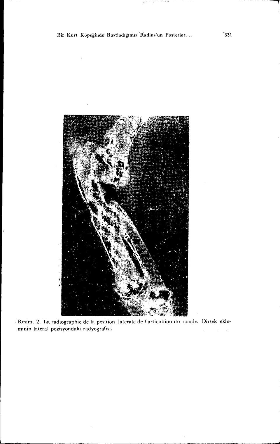 La radiographie de la posilion laleralc de