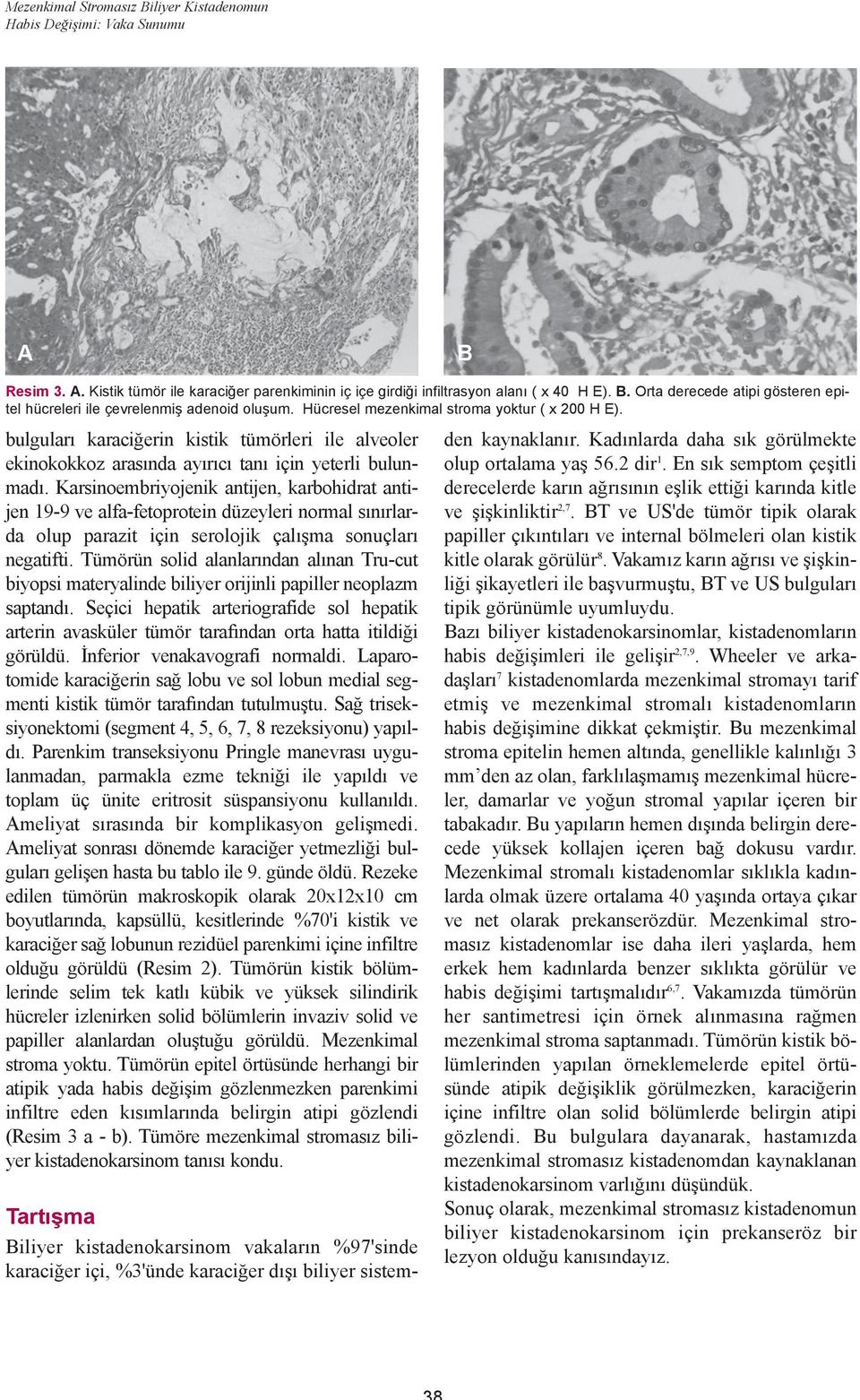 Karsinoembriyojenik antijen, karbohidrat antijen 19-9 ve alfa-fetoprotein düzeyleri normal sýnýrlarda olup parazit için serolojik çalýþma sonuçlarý negatifti.