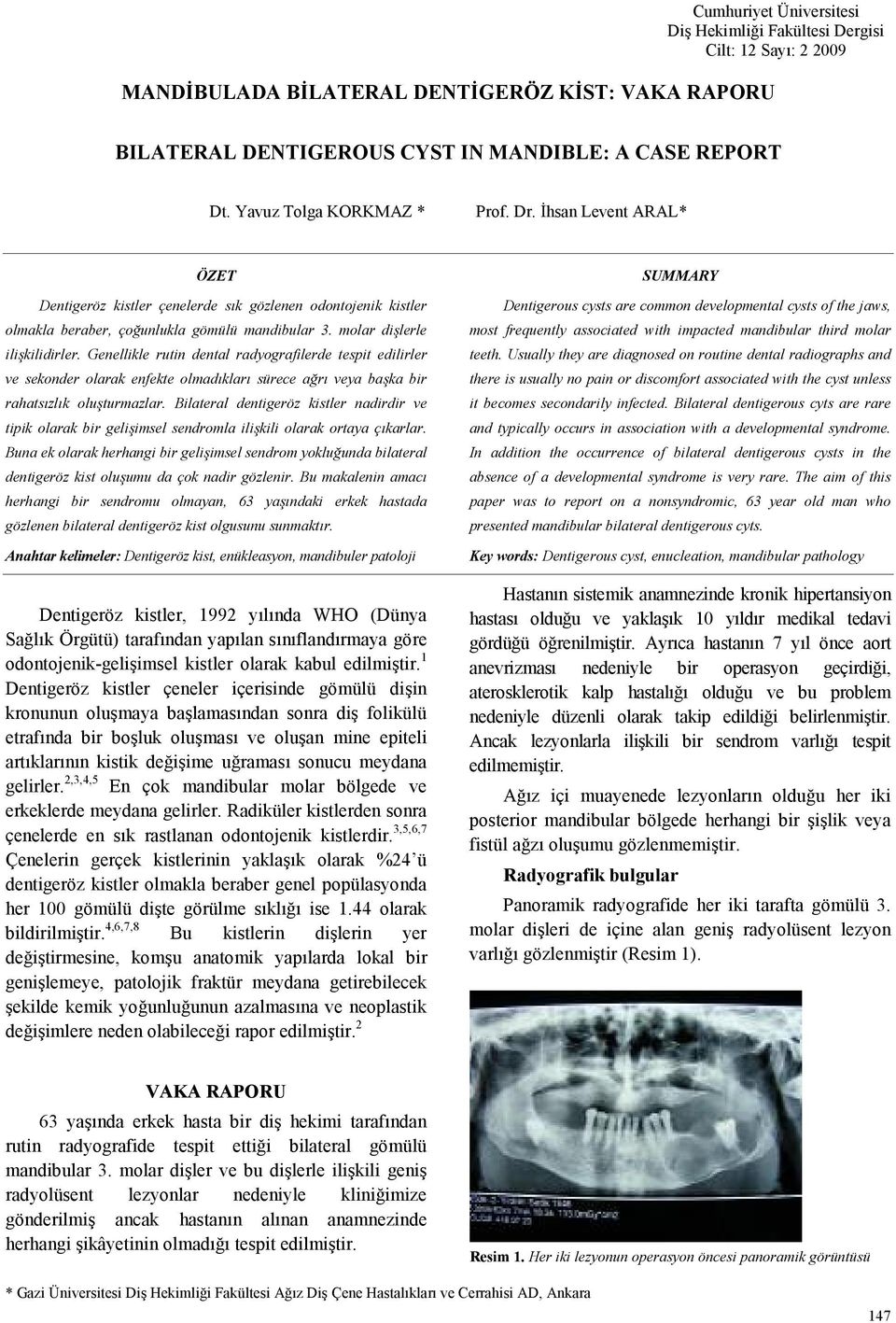 Genellikle rutin dental radyografilerde tespit edilirler ve sekonder olarak enfekte olmadklar sürece ar veya baka bir rahatszlk oluturmazlar.