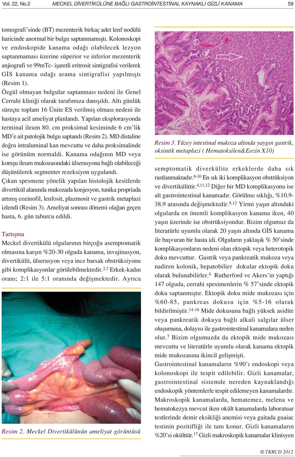 sintigrafisi yap lm flt (Resim 1). Özgül olmayan bulgular saptanmas nedeni ile Genel Cerrahi klini i olarak taraf m za dan fl ld.