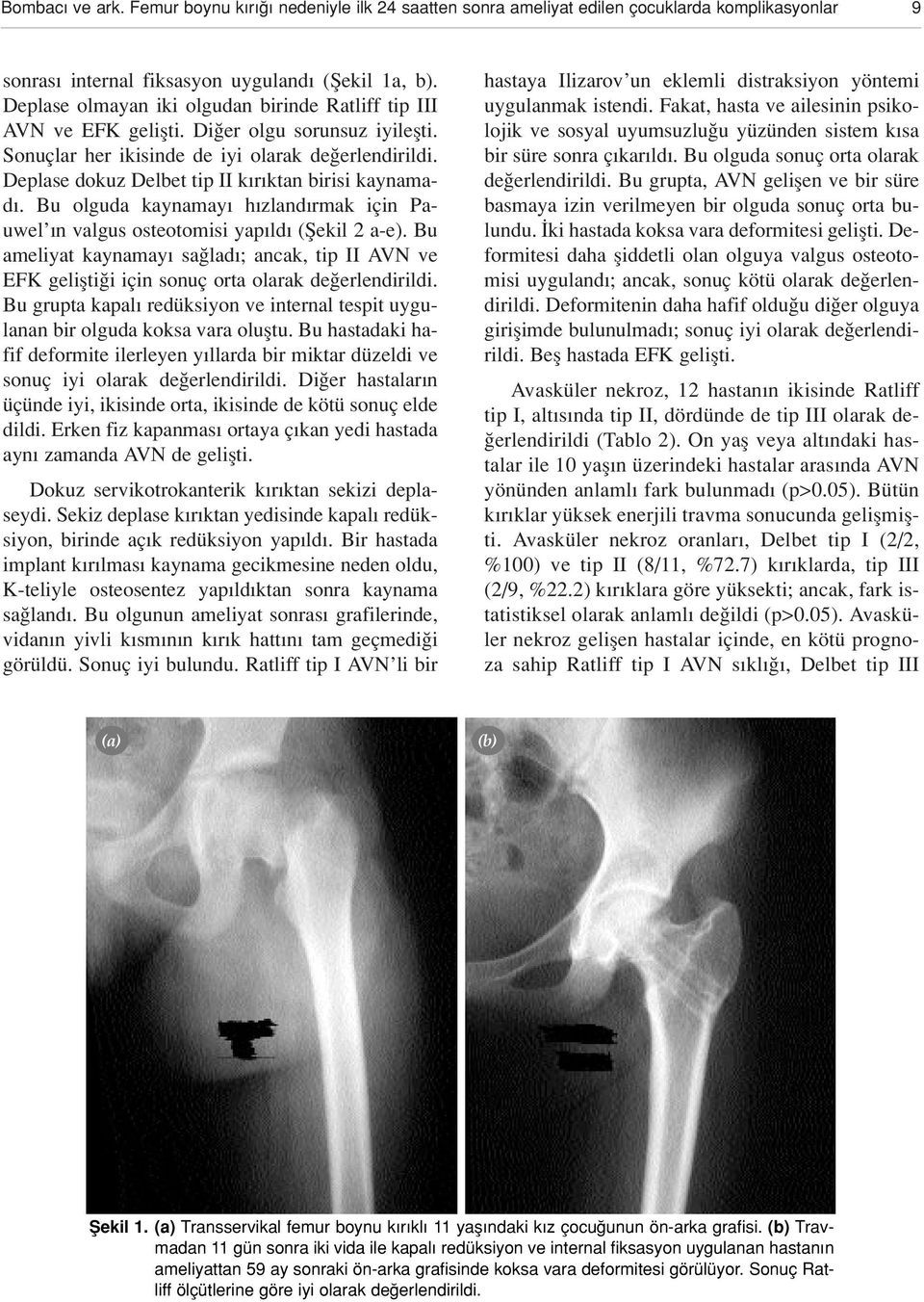 Deplase dokuz Delbet tip II k r ktan birisi kaynamad. Bu olguda kaynamay h zland rmak için Pauwel n valgus osteotomisi yap ld (fiekil 2 a-e).