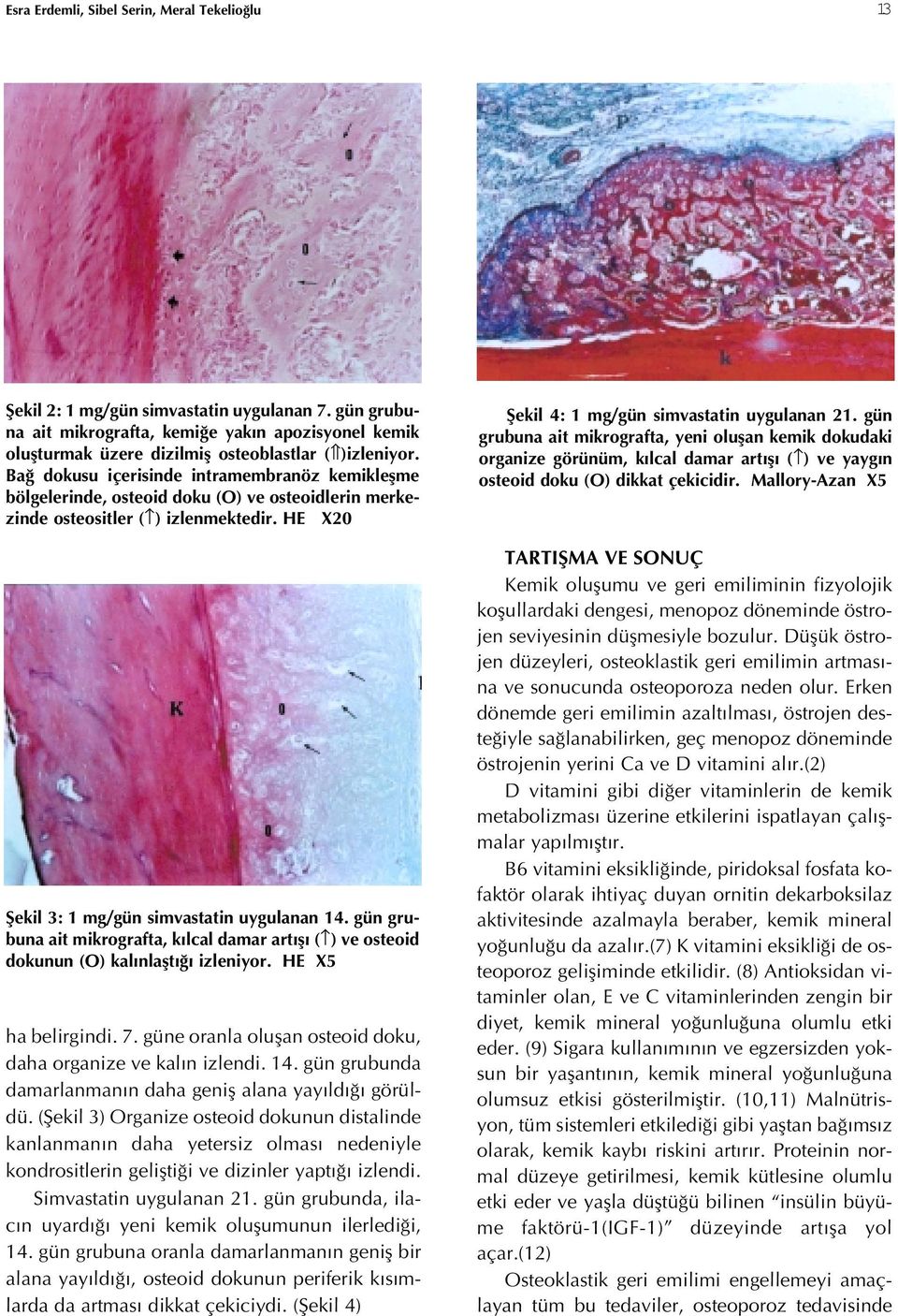 Bağ dokusu içerisinde intramembranöz kemikleşme bölgelerinde, osteoid doku (O) ve osteoidlerin merkezinde osteositler ( ) izlenmektedir. HE X20 Şekil 3: 1 mg/gün simvastatin uygulanan 14.