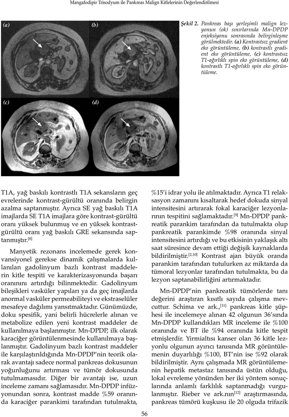 (c) (d) T1A, yağ baskılı kontrastlı T1A sekansların geç evrelerinde kontrast-gürültü oranında belirgin azalma saptanmıştır.