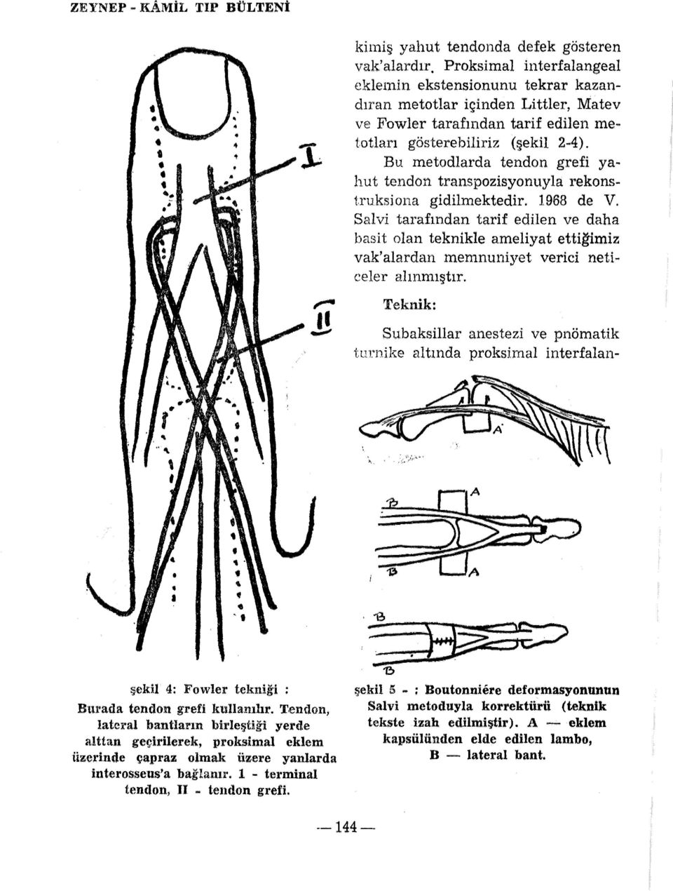 Bu metodlarda tendon grefi yahut te11don transpozisyonuyla rekonstruksiona gidilmektedir. 1968 de V.