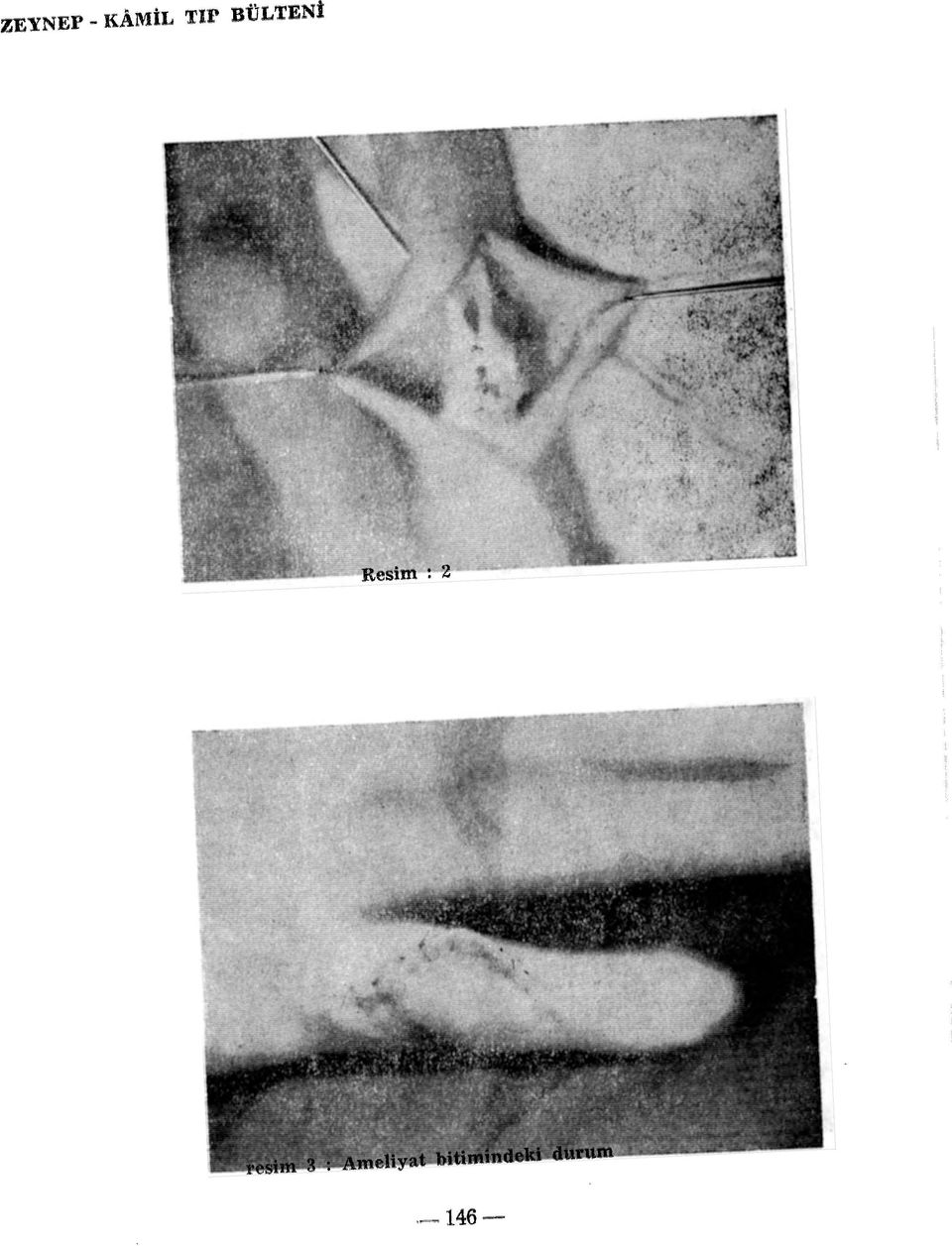 resim 3 : Ameliyat