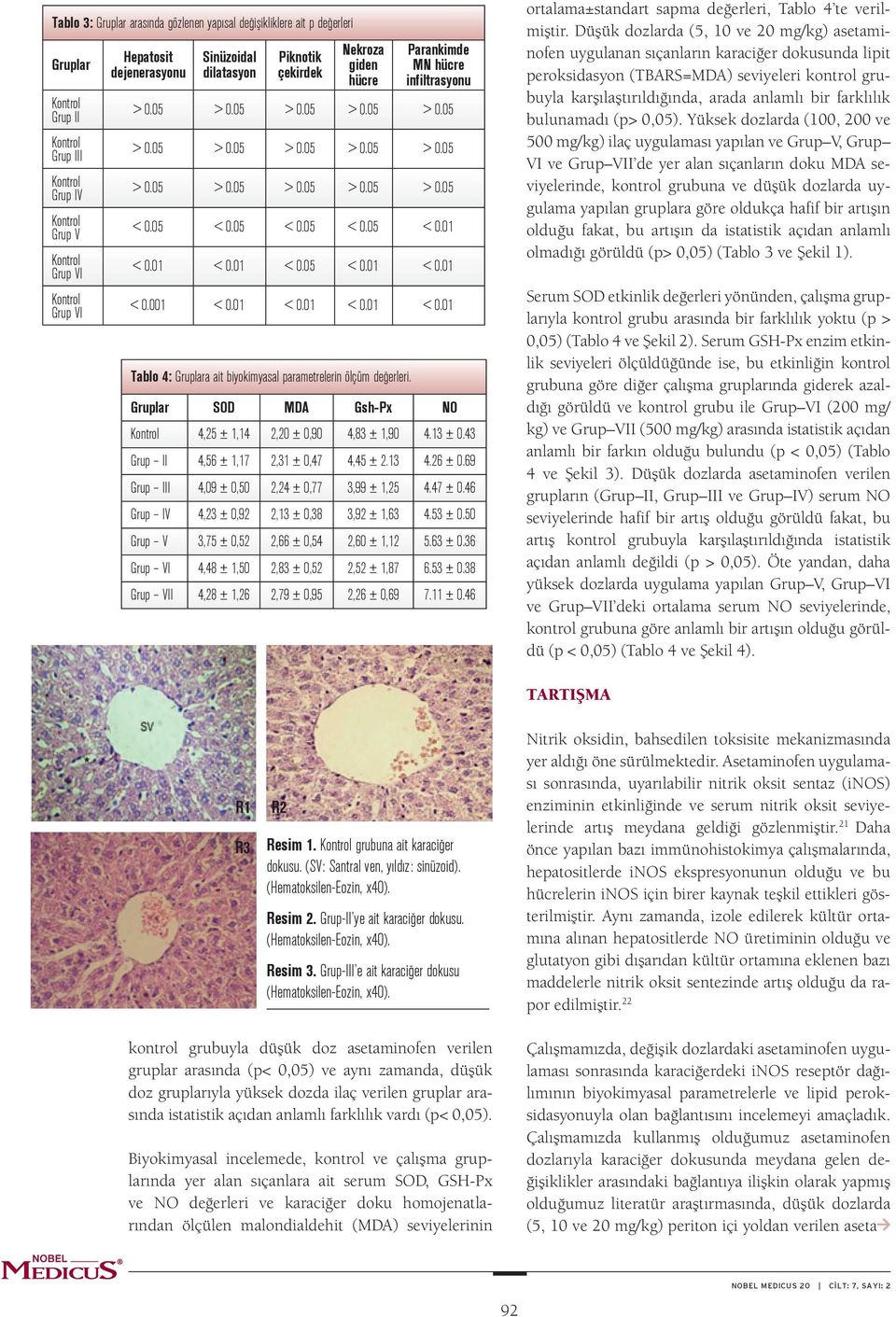 0 < 0.0 < 0.05 < 0.0 < 0.0 < 0.00 < 0.0 < 0.0 < 0.0 < 0.0 Tablo 4: Gruplara ait biyokimyasal parametrelerin ölçüm değerleri. Gruplar SOD MDA Gsh-Px NO 4,5 ±,4,0 ± 0,90 4,83 ±,90 4.3 ± 0.