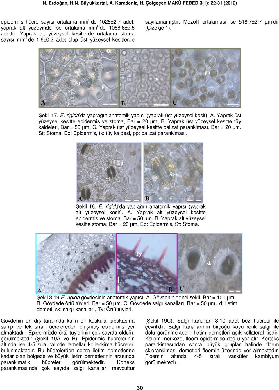 rigida da yaprağın anatomik yapısı (yaprak üst yüzeysel kesit).. Yaprak üst yüzeysel kesitte epidermis ve stoma, ar = 20 µm,. Yaprak üst yüzeysel kesitte tüy kaideleri, ar = 50 µm,.