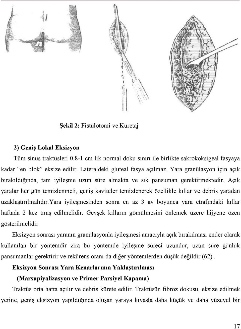 Açık yaralar her gün temizlenmeli, geniş kaviteler temizlenerek özellikle kıllar ve debris yaradan uzaklaştırılmalıdır.