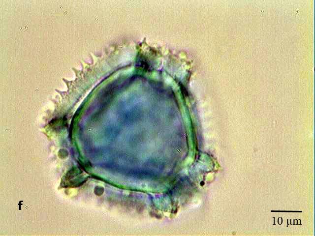 Şekil 4.79. S. oleraceus polenleri a. Ekvatoral eksen b. Polar eksen c. Ekvatoral eksen d.