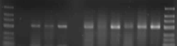 İncir mozaik hastalığı ile enfekteli Bursa Siyahı incir yapraklarından elde edilen dsrna lar ve İncir mozaik ilişkili virüs-1 primerleri kullanılarak yapılan RT-PCR testi sonucunda