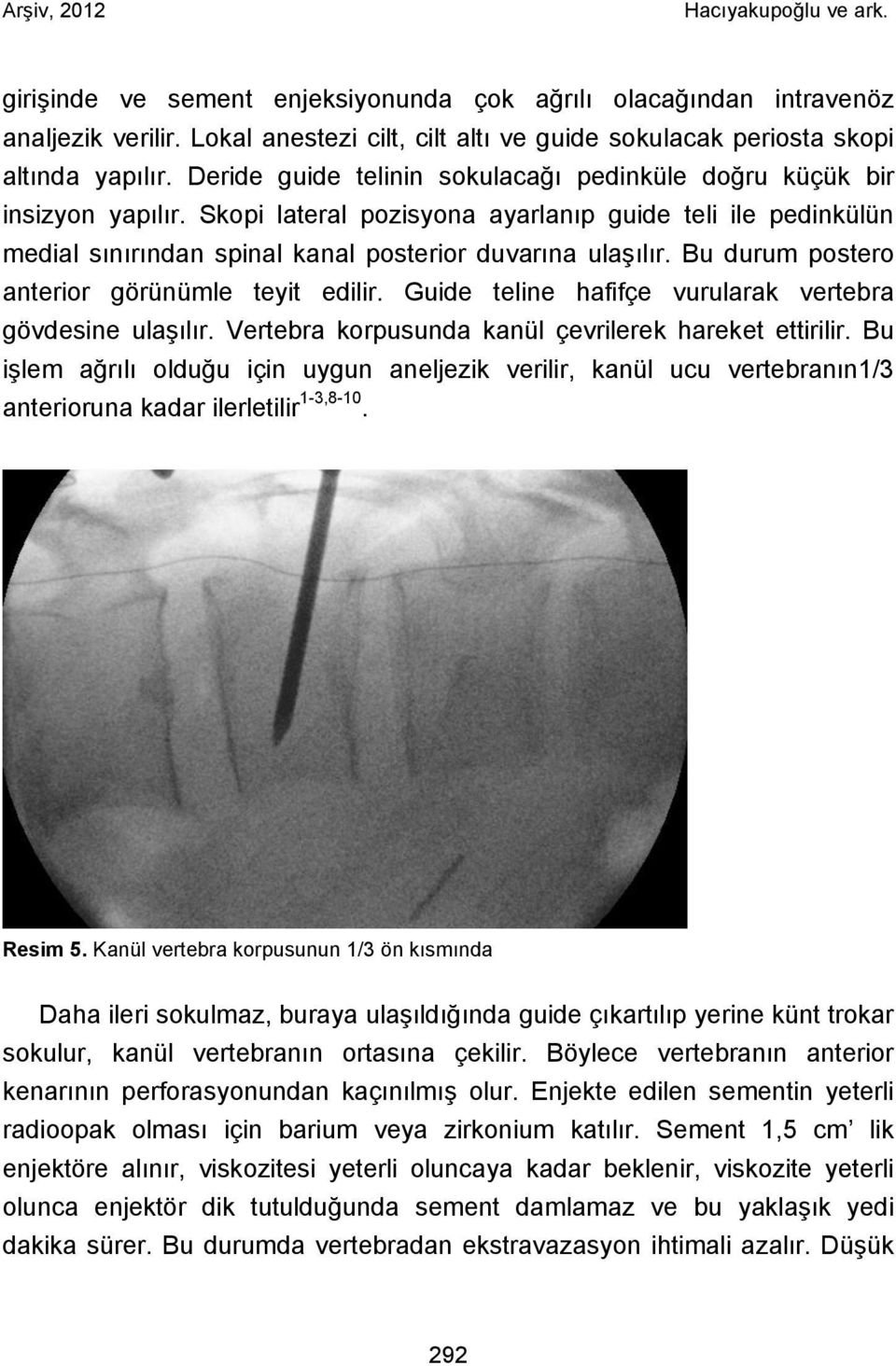 Bu durum postero anterior görünümle teyit edilir. Guide teline hafifçe vurularak vertebra gövdesine ulaşılır. Vertebra korpusunda kanül çevrilerek hareket ettirilir.