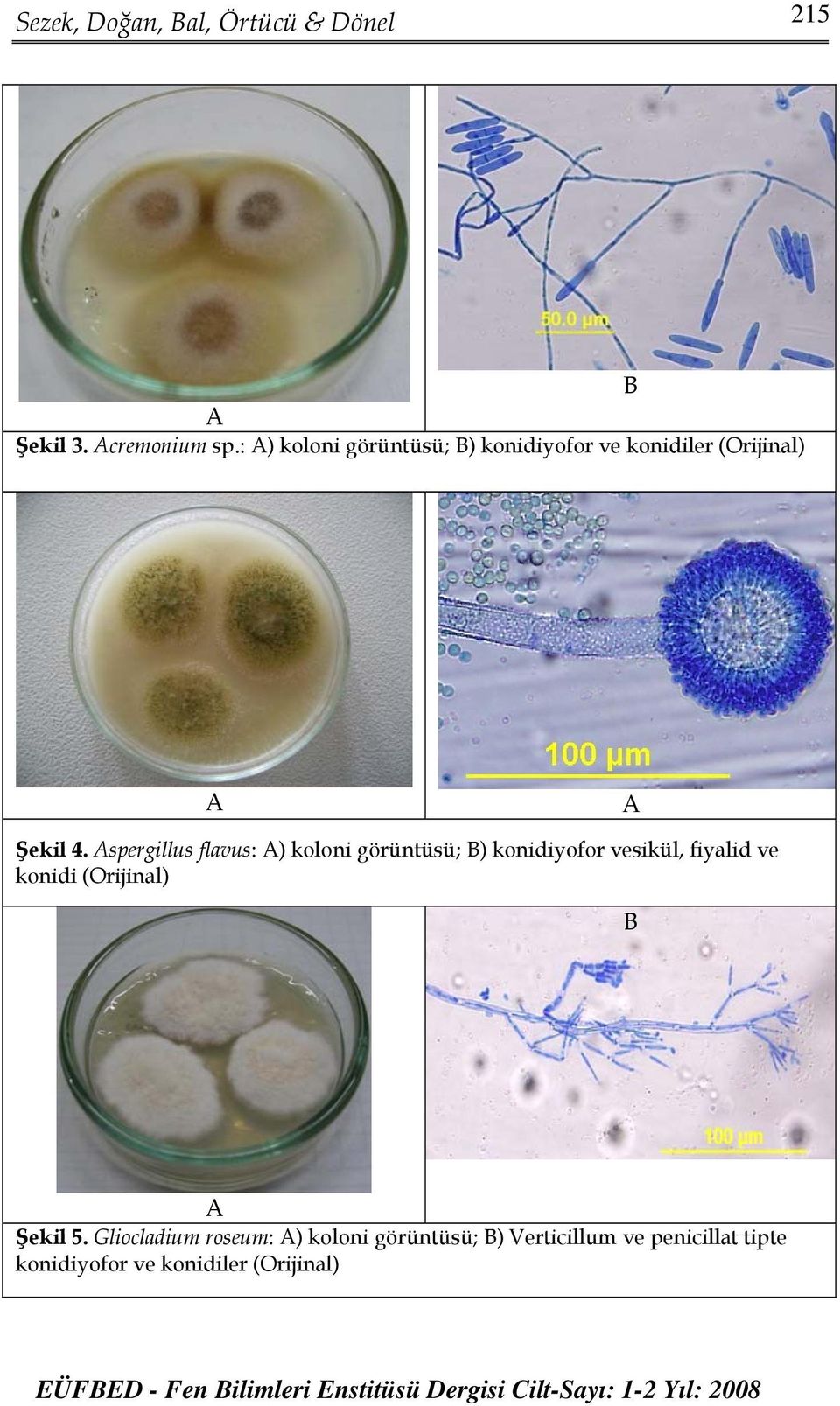 spergillus flavus: ) koloni görüntüsü; ) konidiyofor vesikül, fiyalid ve konidi