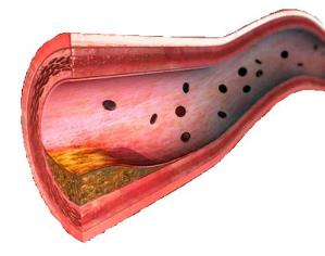 Kardiyovasküler sistem üzerine varsayılan GLP-1 etkileri Böbrekler Sodyum yükü ve volüm artışına cevap olarak diürezi ve sodyum atılımını artırır GLP-1 Kalp (miyokard) Glukoz alımını artırır