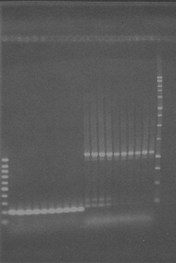 4.BULGULAR VE TARTIŞMA Sulzinski (1996) Manulis (1994) 1.2 kb 197 bp Şekil 4.27. Manulis ve ark. (1994) ile Sulzinski (1996) nın primerleriyle yapılan PCR işleminde oluşan bantlar.