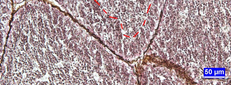 Retiküler iplik boyaması (gümüşleme) ile retiküler ipliklerin IFE yi oluşturan epitel hücrelerinin bazalinde yoğunlaştığı, folikülleri dışarıdan çepeçevre sardığı ve korteks bölümüne de ağ tarzında