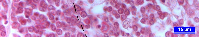 Şekil 14: 10 haftalık keklikten alınan bursa Fabricii kesiti. Korteksteki pironinofilik hücrelerin medulaya göre daha yoğun olduğu görülmekte. MGP boyama.