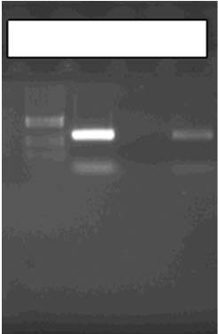 İmmün Sistemi Baskılanmış Bir Çocukta Microsporidium spp. Enfeksiyonunun Polimeraz Zincir Reaksiyonu ile Tanımlanması 1 2 3 4 250 bç 270 bç Resim 2. Agaroz jelde E.