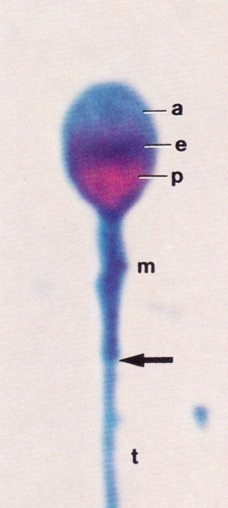 SPERMAC BOYASI a: akrozom e: ekvatoryal bölge p: post-akrozomal bölge