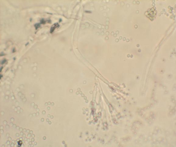 i) Penicillium citrinum THOM ġekil 4.15. Penicillium citrinum CYA besiyerinde 7 günlük koloni görünümü.