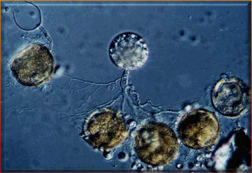 Mantar grupları Chytridler Kitritler Esasen sucul, Bazı saprofitik, diğerleri bitkiler ve hayvanlar üzerinde bir hücreli parazitik, Tek