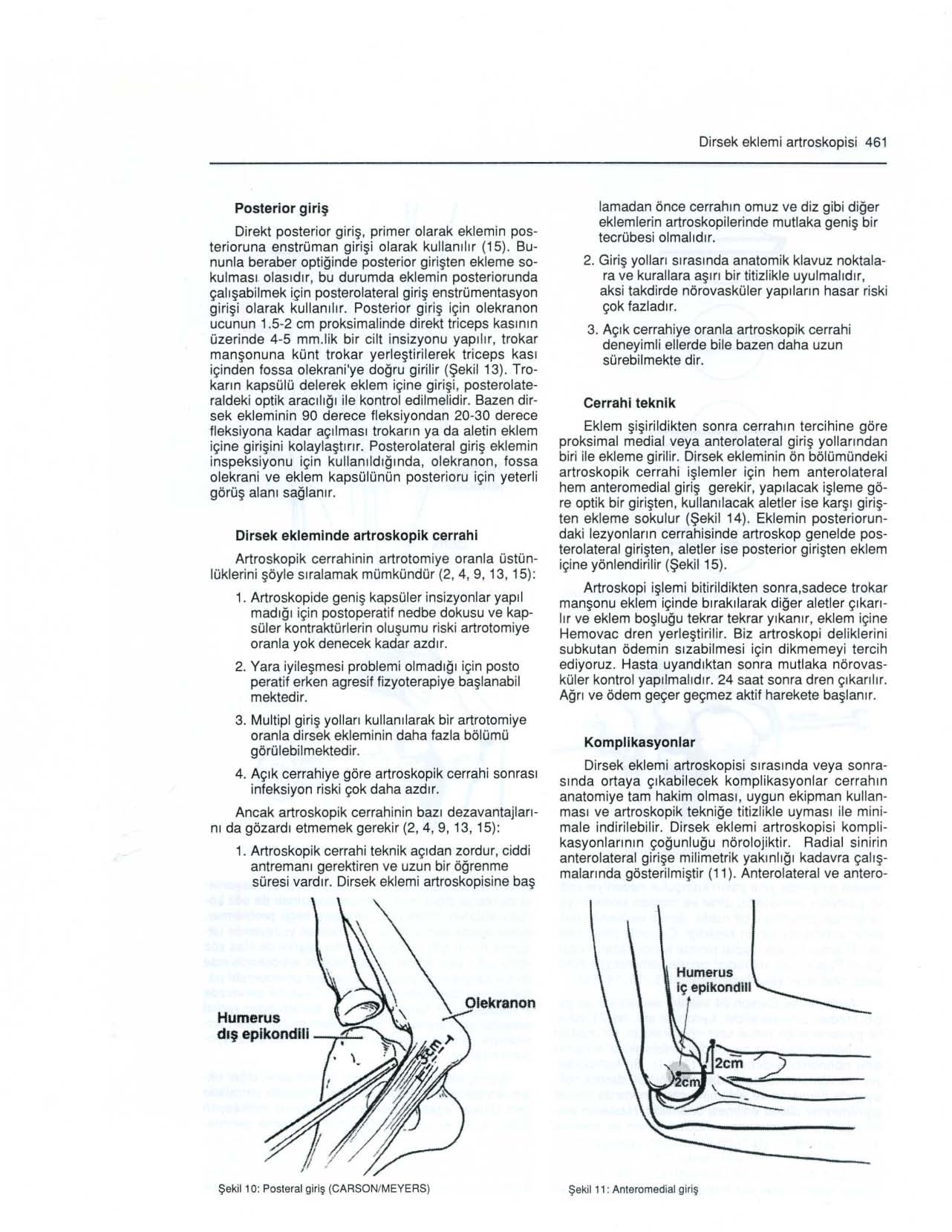 Dirsek eklemi artroskopisi 461 Posterior giriş Direkt posterior giriş, primer olarak eklemin posterioruna enstrüman girişi olarak kullanılır (15).