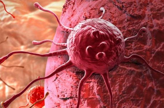 Patolog/Hematolog/Sitologlar; Aralarındaki dil birliğinin sağlanması, Sağlık kuruluşları; Neoplazmın köken aldığı yerleşim yeri, tanı tarihi, histolojik tipi ve davranışı (örn; in situ ya da malign)