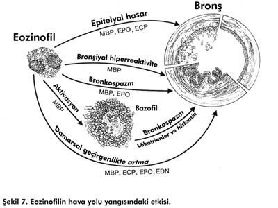 g) Özellikle bronş mukozasındaki epitel hücrelerinde deskuamasyona neden olur. Genel olarak ECP nin sitotoksik etki mekanizması net anlaşılmamıştır.