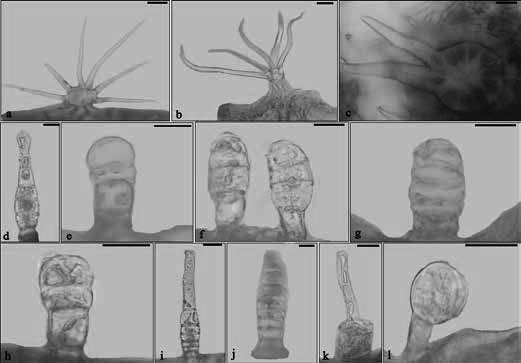 Türkiye de Yayılış Gösteren Cistus L. (Cistaceae) Cinsinin Karşılaştırmalı Yaprak Anatomisi Şekil 4. Cistus türlerinin Trikom (tüy) yapıları. Örtü tüyleri (a-c); Salgı tüyleri (d-l). a) C.