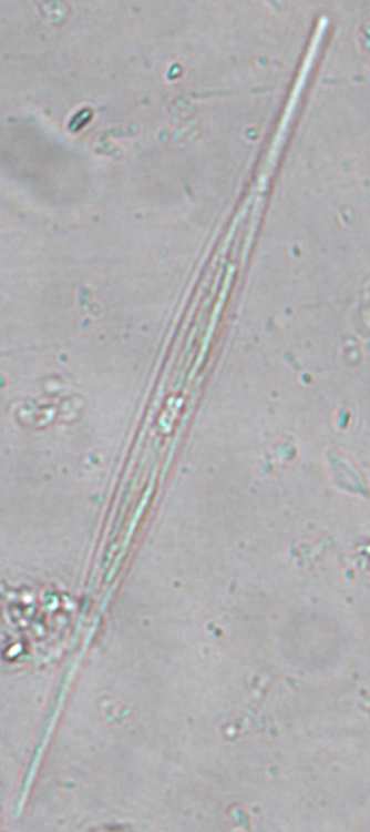 EK 2 Bacillariophyta ya ilişkin fotoğraflar 1 2 3 4 Şekil 5. Pennales: 1. Nitzschia acicularis (Kützing) W.