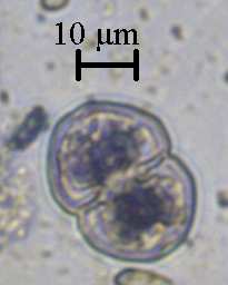 EK 3 Chlorophyta ya ilişkin fotoğraflar 1 2 3 5 4 6 7 8 Şekil 6. Chlorophyta: Chlorophyta 1. Actinastrum hantzschii Lagerheim 2. Closterium aciculare T. West 3. C. praelongum Brebisson 4.