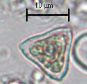 EK 3 Chlorophyta ya ilişkin fotoğraflar 1 2 3 4 5 6 Şekil 9. Chlorophyta: 1. Schroederia setigera (Schröeder) Lemmermann 2.