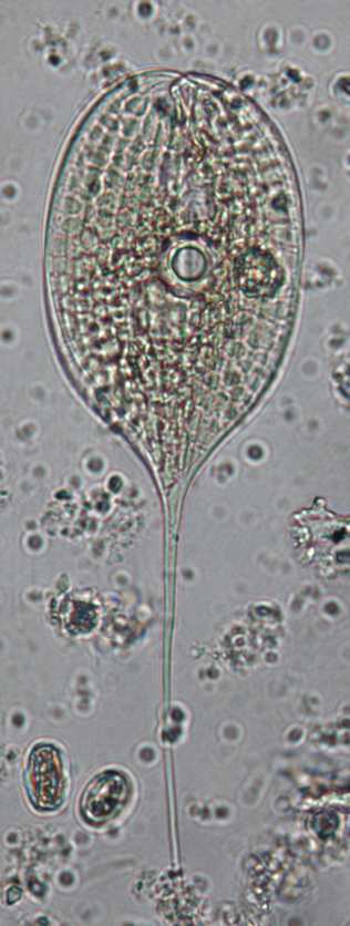 EK 8 Euglenophyta ya ilişkin fotoğraflar 1 2 3 5 4 6 Şekil 14. Euglenophyta Euglenophyta: 1. Euglena acus Ehrenberg 2. E. tripteris (Dujardin) Klebs 3.