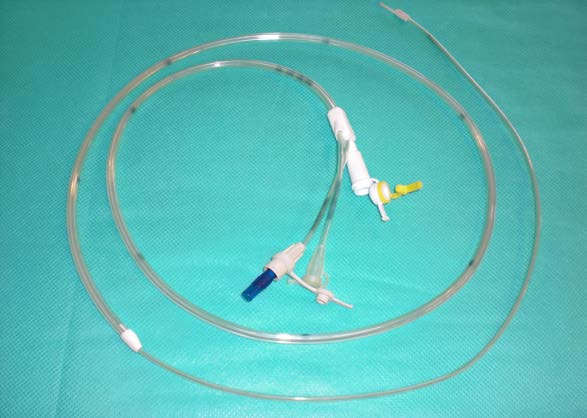 Transnazal endoskopik post-pilorik tüp yerleştirilmesi: Bu yöntem yenilerde geliştirilmiş olup az kullanılmaktadır.