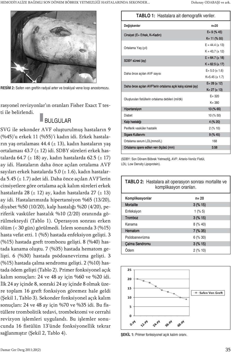 BULGULAR SVG ile se kon der AVF oluş tu rul muş has ta la rın 9 (%45) u er kek 11 (%55) i ka dın idi. Er kek has ta la - rın yaş or ta la ma sı 44.4 (± 13), ka dın has ta la rın yaş or ta la ma sı 43.