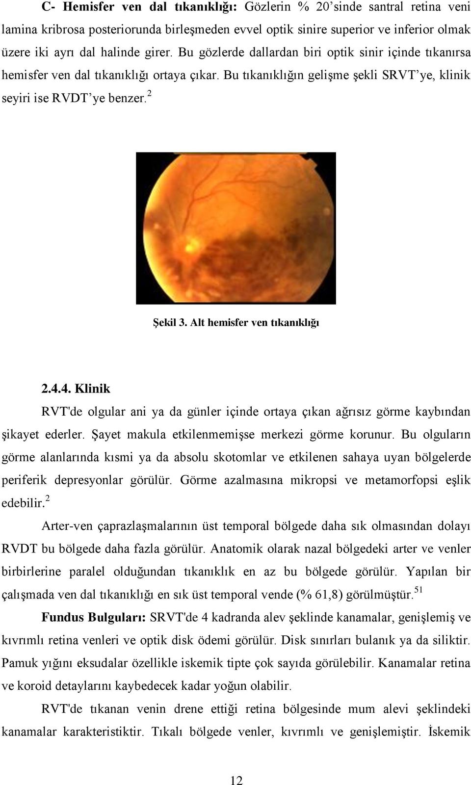 optik sinire superior ve inferior olmak üzere iki ayrı dal halinde girer. Bu gözlerde dallardan biri optik sinir içinde tıkanırsa hemisfer ven dal tıkanıklığı ortaya çıkar.