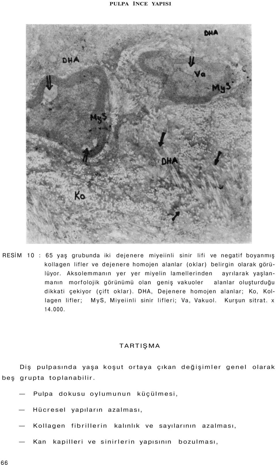 DHA, Dejenere homojen alanlar; Ko, Kollagen lifler; MyS, Miyeiinli sinir lifleri; Va, Vakuol. Kurşun sitrat. x 14.000.