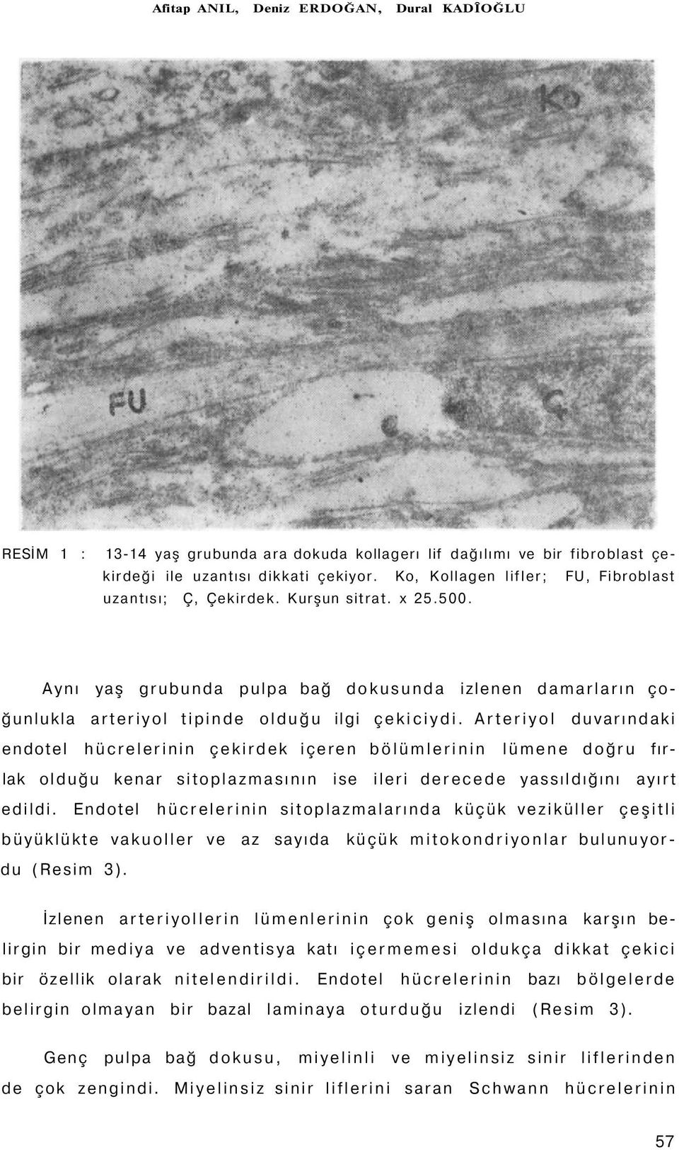 Arteriyol duvarındaki endotel hücrelerinin çekirdek içeren bölümlerinin lümene doğru fırlak olduğu kenar sitoplazmasının ise ileri derecede yassıldığını ayırt edildi.