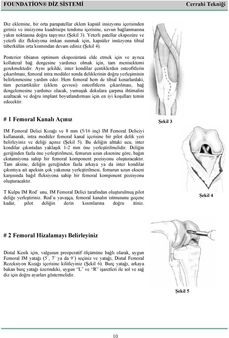 Posterior tibianın optimum ekspozürünü elde etmek için ve ayrıca kollateral bağ dengesine yardımcı olmak için, tam menisektomi gerekmektedir.