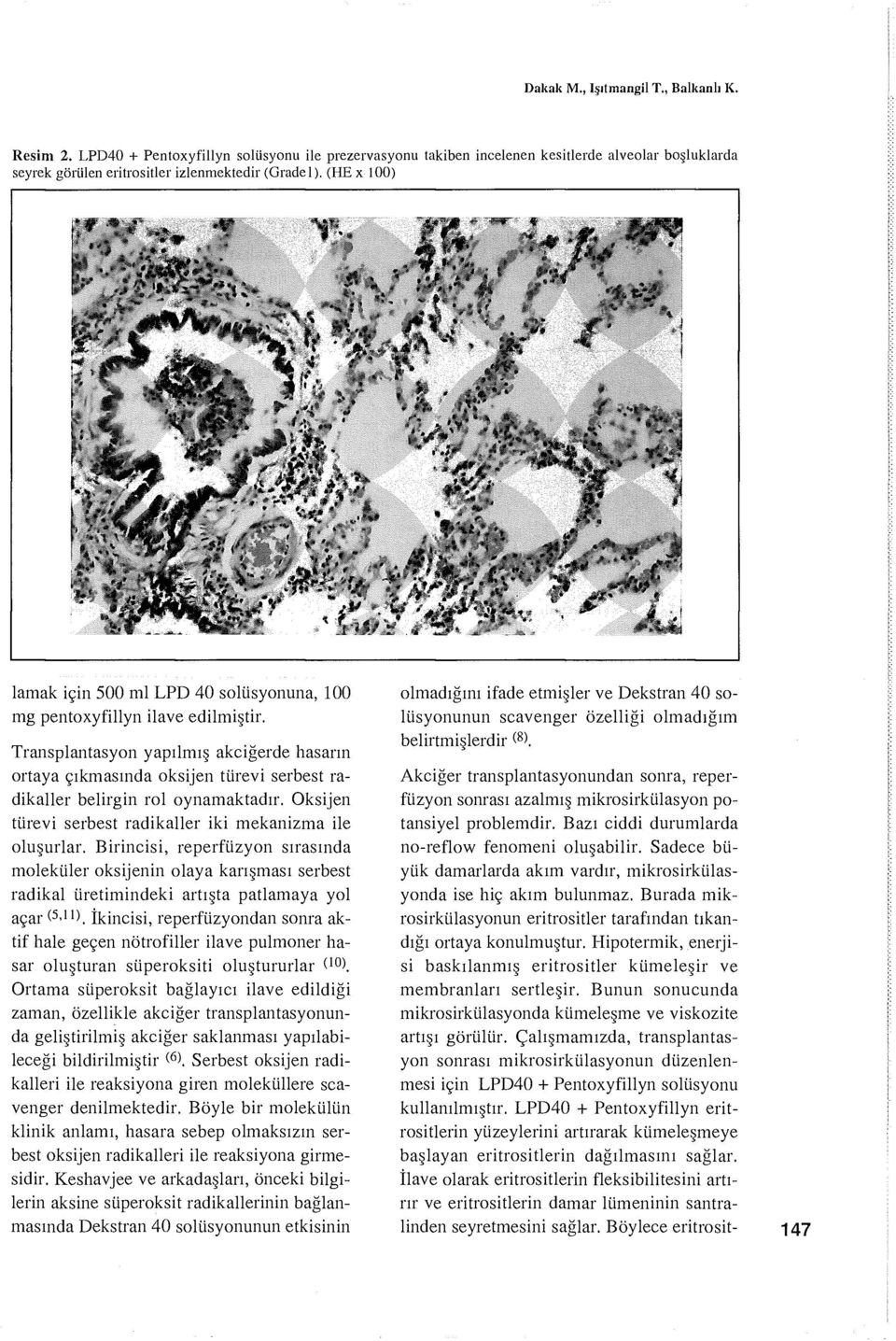 Transplantasyon yapılmış akciğerde hasarın ortaya çıkmasında oksijen türevi serbest radikaller belirgin rol oynamaktadır. Oksijen türevi serbest radikaller iki mekanizma ile oluşurlar.